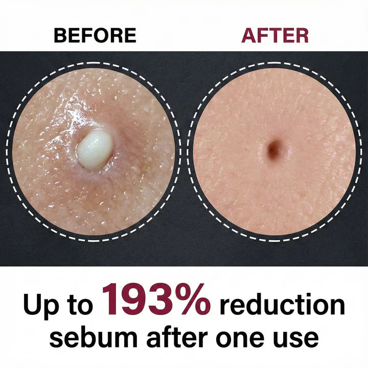 Dr Melaxin™ Peel Shot Glow Rice Ampoule Duo