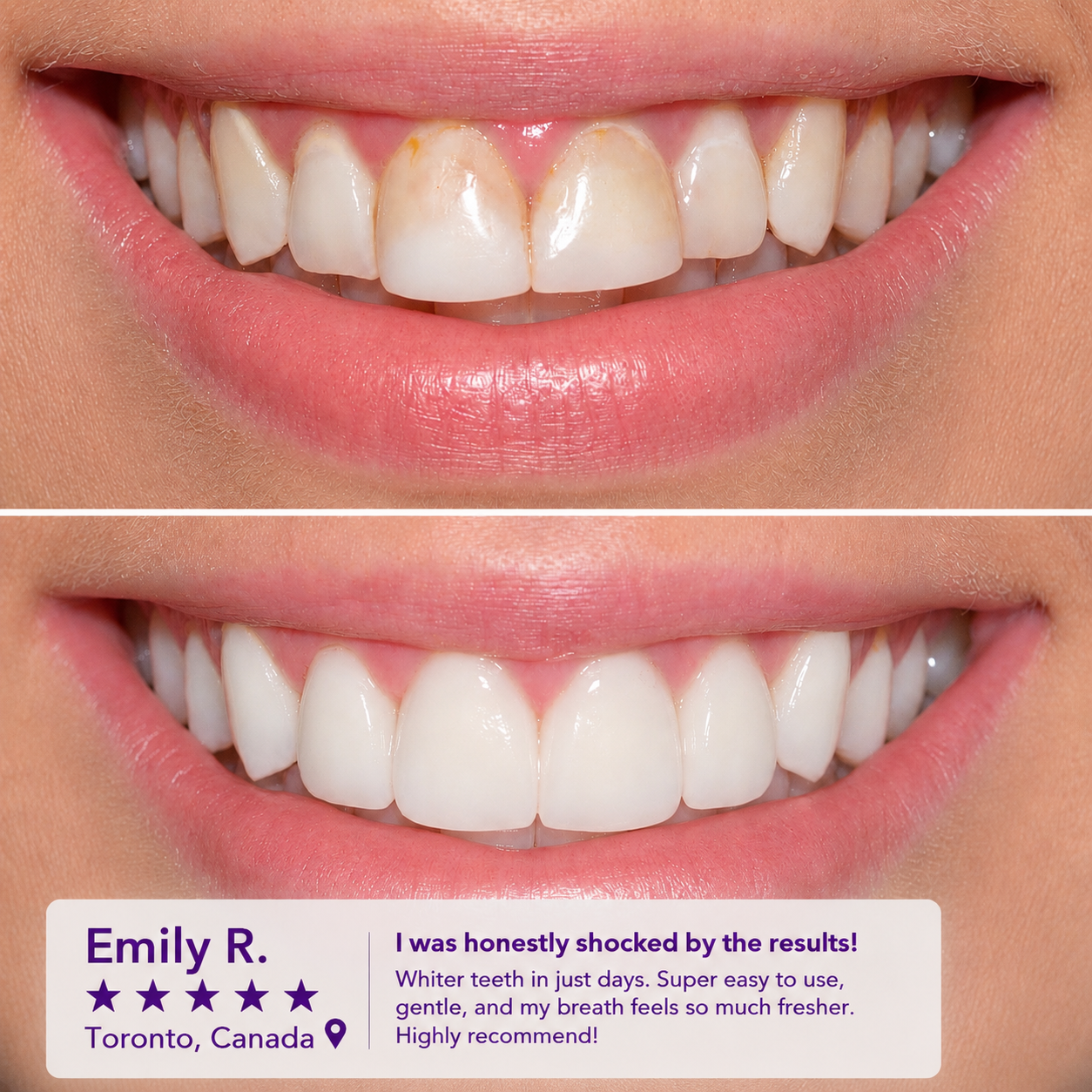Dr Dent Purple MouthWash®